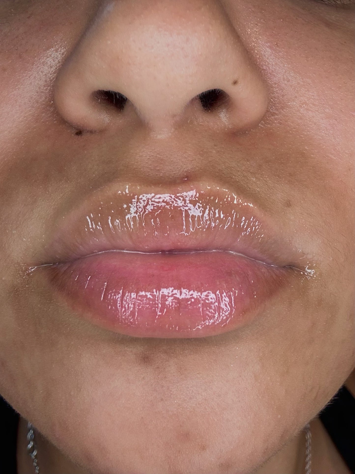 Whipped Pineapple - Lip Balm